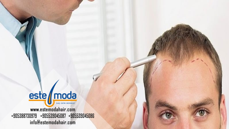 No 1 Hair Transplant Clinic In India