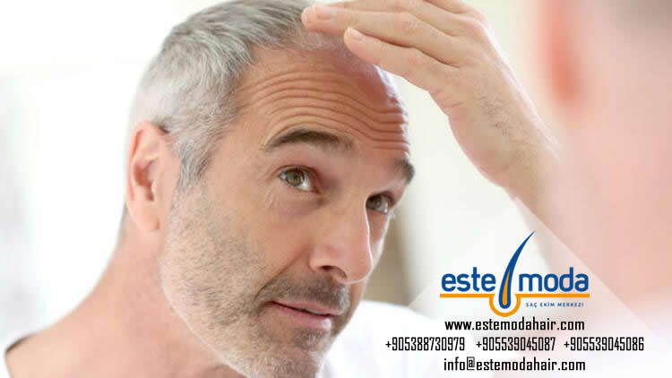 Hair Transplant With Less Donor Area